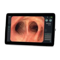 [307000] EickView SD Monitor de endoscopia pantalla táctil de 15,6_